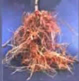 nematode attacked root